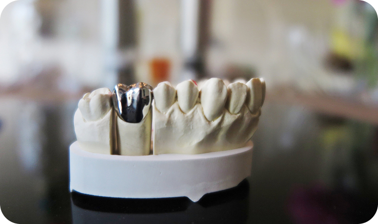 close up dentures table 1