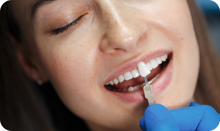 dentist white teeth 1