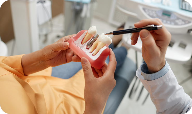 woman holding tooth model consultation dental implant 1